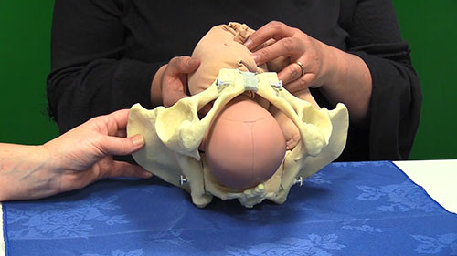 枕后位的分娩机制