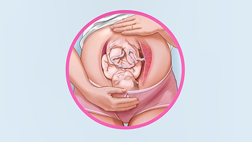 分娩的前兆症状