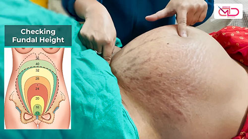 产科四步触诊法