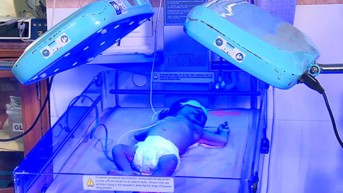 新生儿黄疸蓝光护理