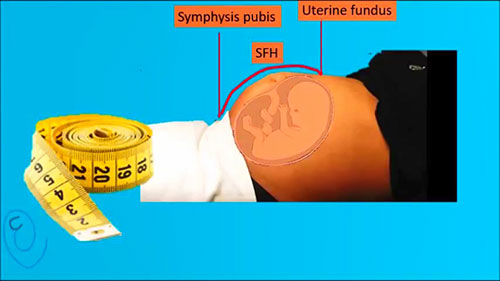 联合基底高度测量