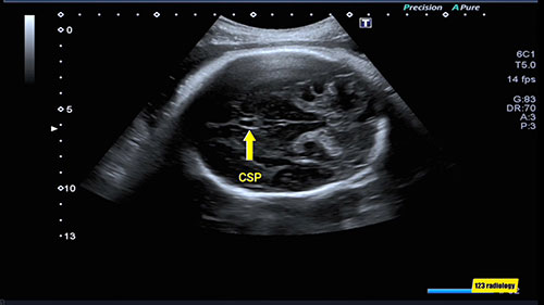 胎儿多普勒测量