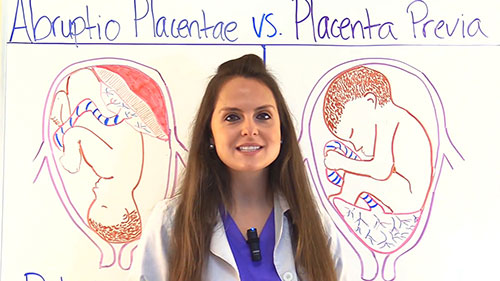 胎盘早剥与前置胎盘护理