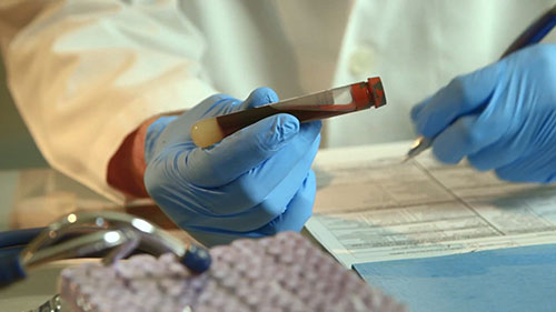 怀孕期间的基因检测