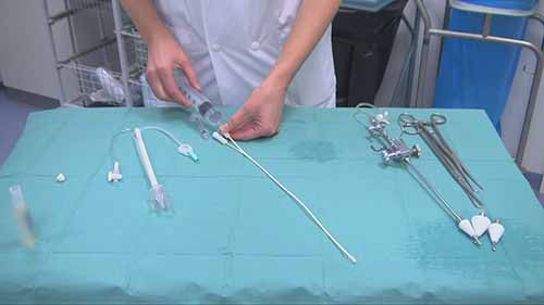 子宫输卵管造影