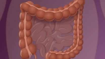 对氨基水杨酸钠的作用机制