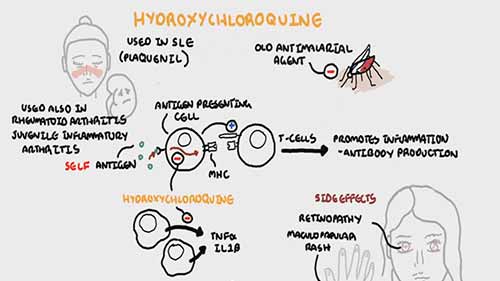 羟氯喹