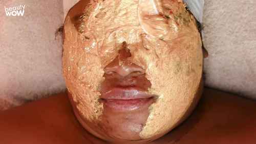 祛除痤疮和色素沉着