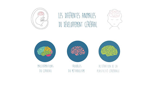 智力障碍儿童的诊断与治疗