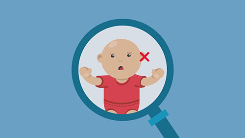 听力障碍儿童的检查