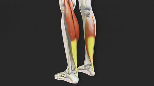 跟腱断裂康复