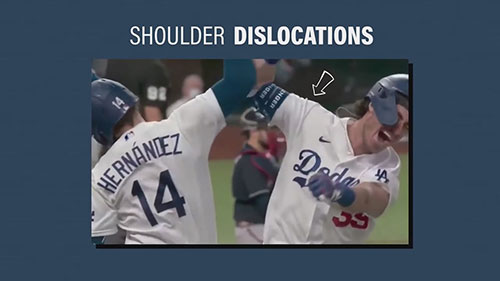 肩关节脱位的康复训练