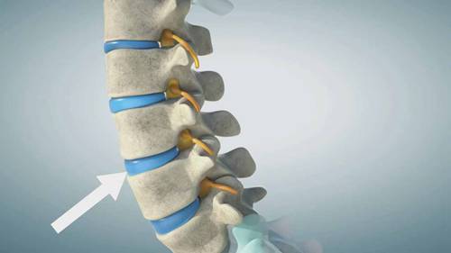 慢性疼痛康复训练 05