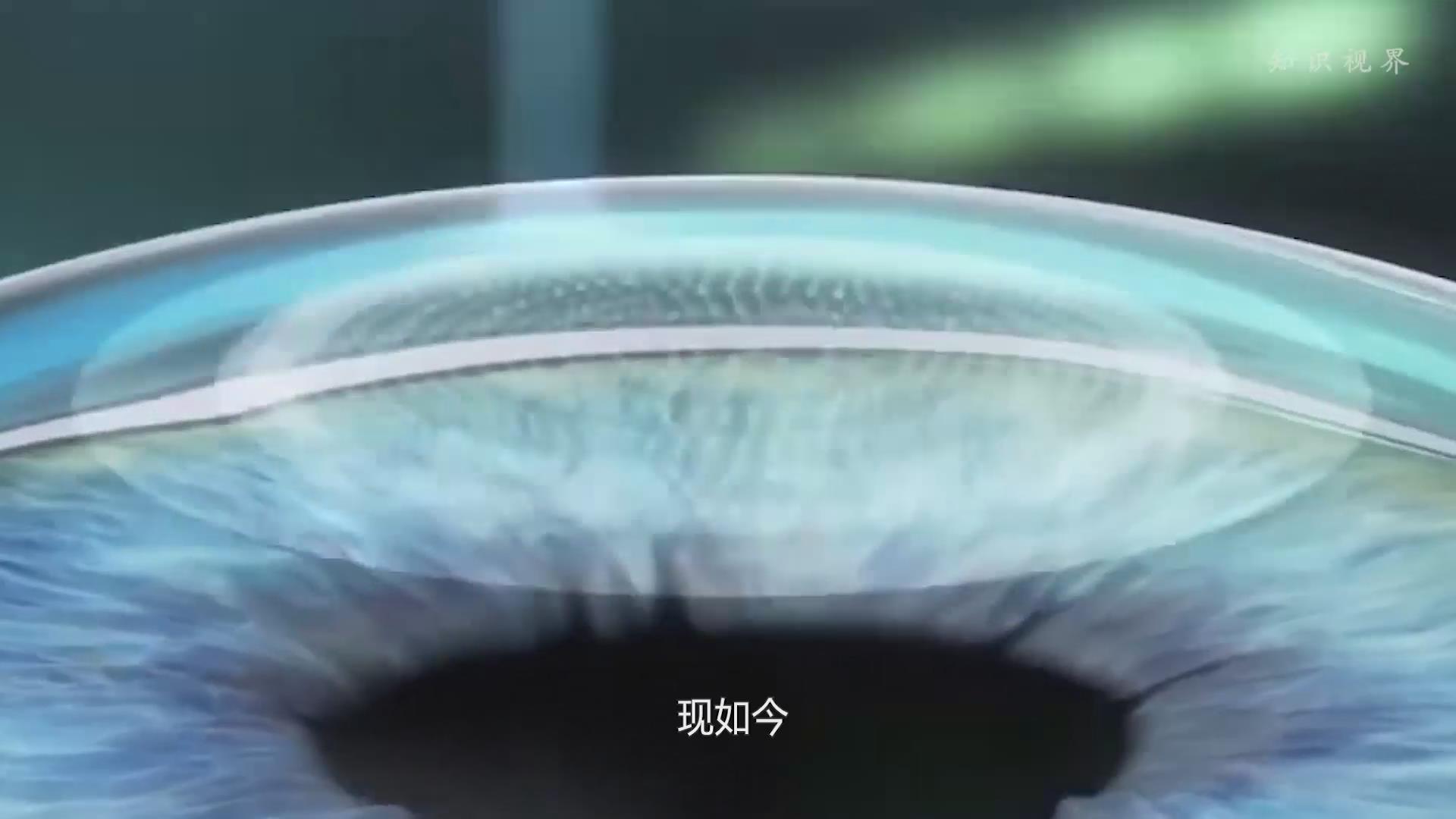 盘点3种近视矫正手术